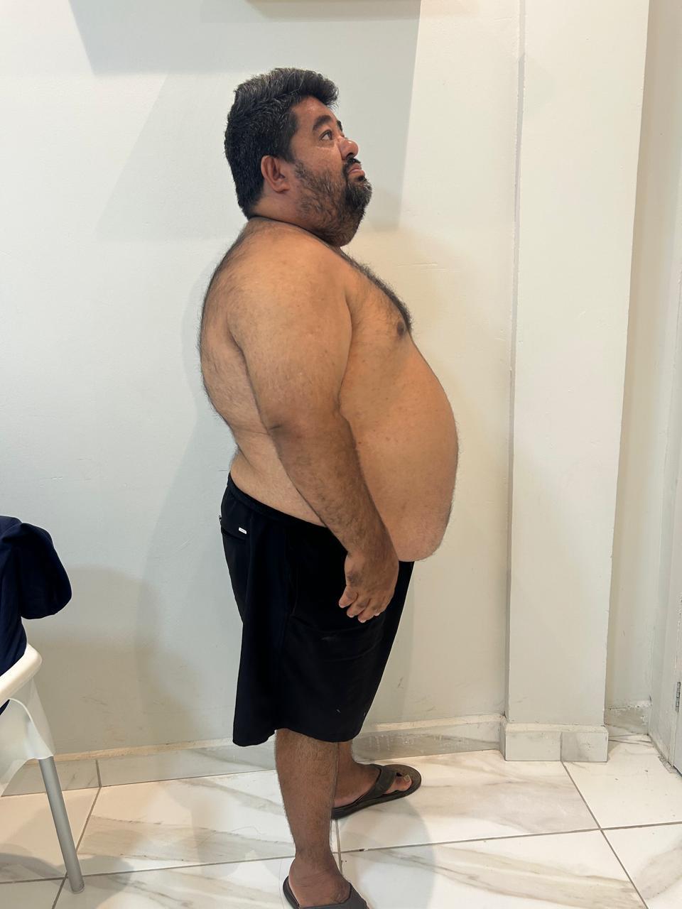Caso 1 — Antes