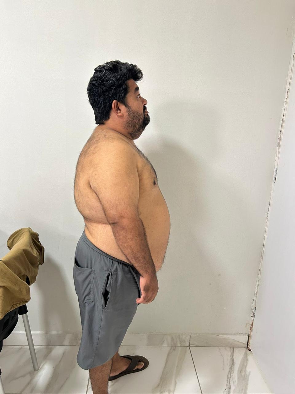 Caso 1 — Depois